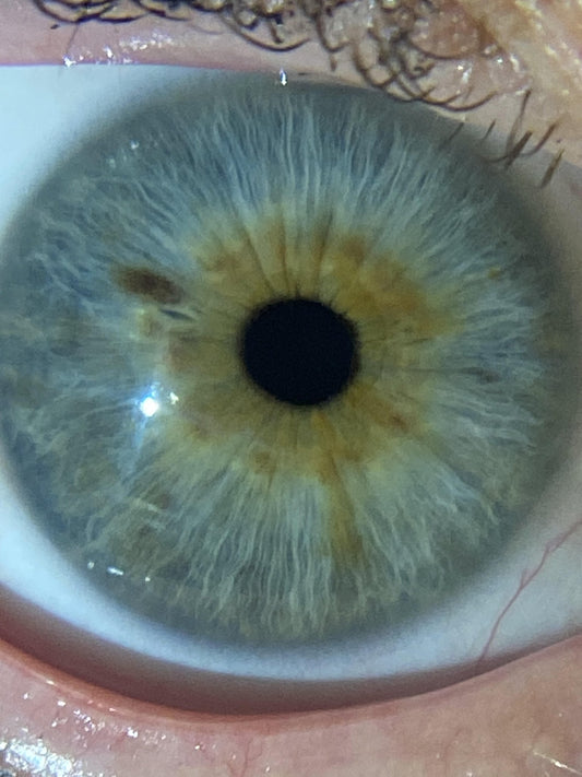 IRIDOLOGY: What Your Eyes Can Reveal About Your Health - The Healing Happy Method